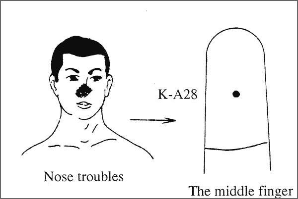 nose_trbl