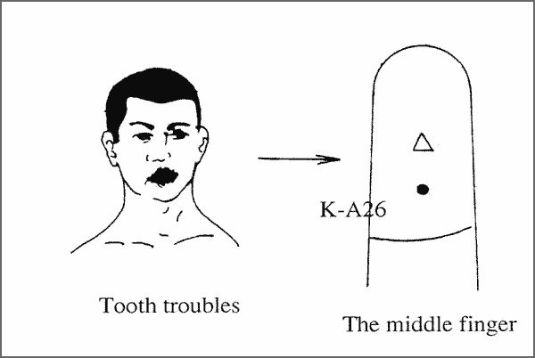tooth_ache